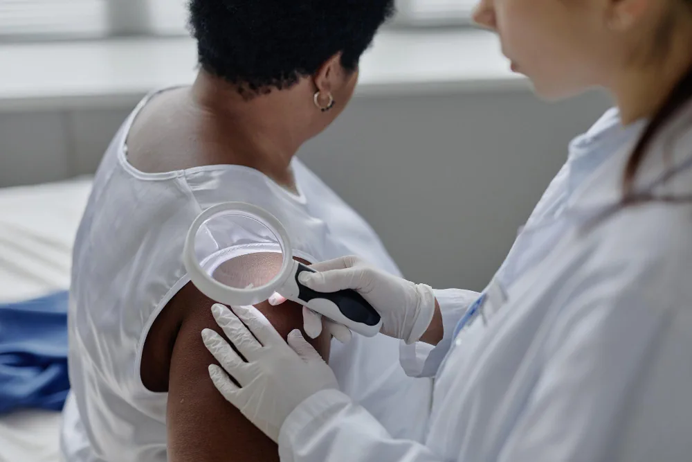 PPD Tuberculosis skin test